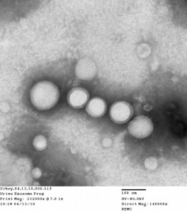 Exosome_micrograph